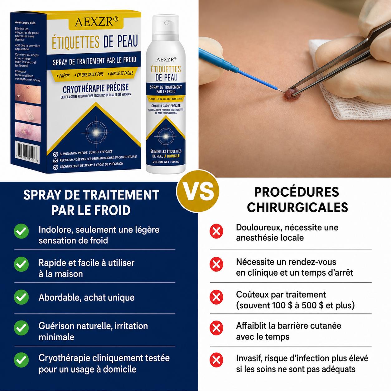 AEXZR® Spray de Traitement par le Froid pour Étiquettes de Peau🧊 Cryo-Tech de Précision : Élimine les grains de beauté et verrues en quelques secondes – Sans lames, sans douleur.