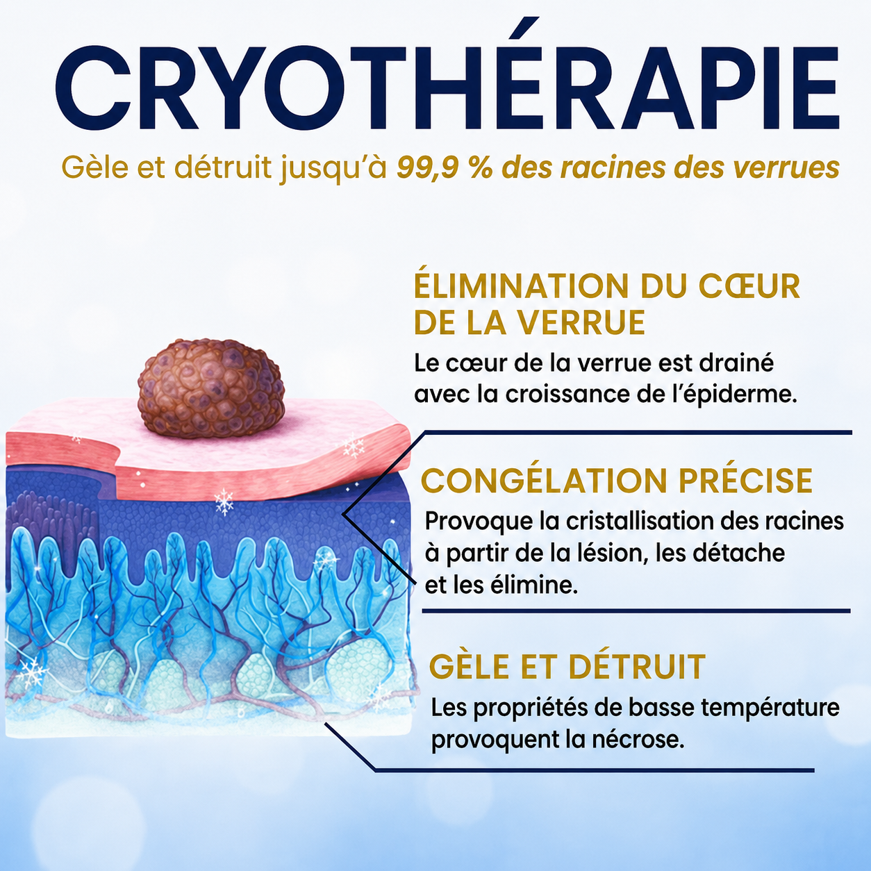 AEXZR® Spray de Traitement par le Froid pour Étiquettes de Peau🧊 Cryo-Tech de Précision : Élimine les grains de beauté et verrues en quelques secondes – Sans lames, sans douleur.