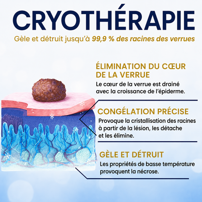 AEXZR® Spray de Traitement par le Froid pour Étiquettes de Peau🧊 Cryo-Tech de Précision : Élimine les grains de beauté et verrues en quelques secondes – Sans lames, sans douleur.